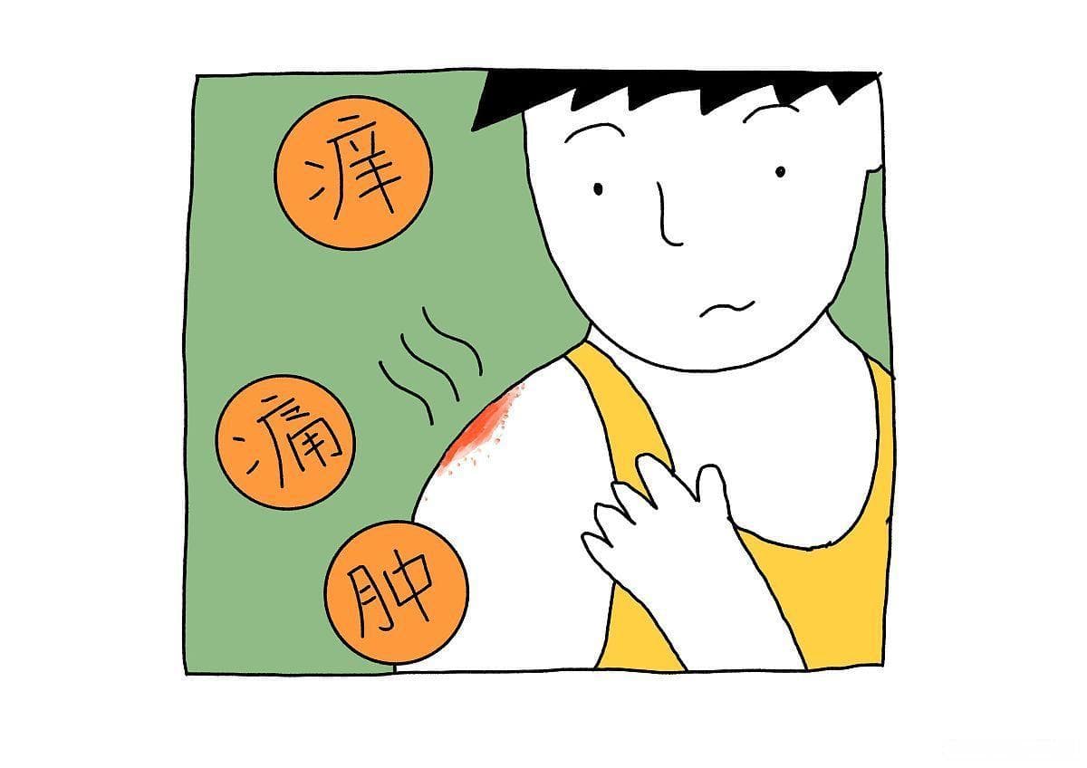 被马蜂或者蜜蜂蜇伤后需要采取哪些处理？