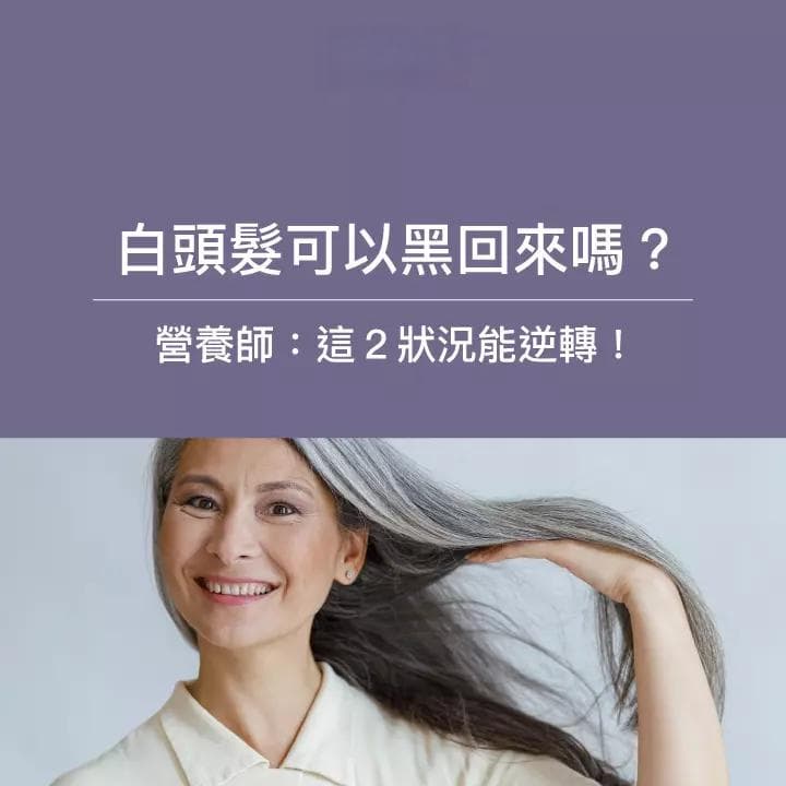 白头发可以变黑吗？5大营养素助你改善白发问题