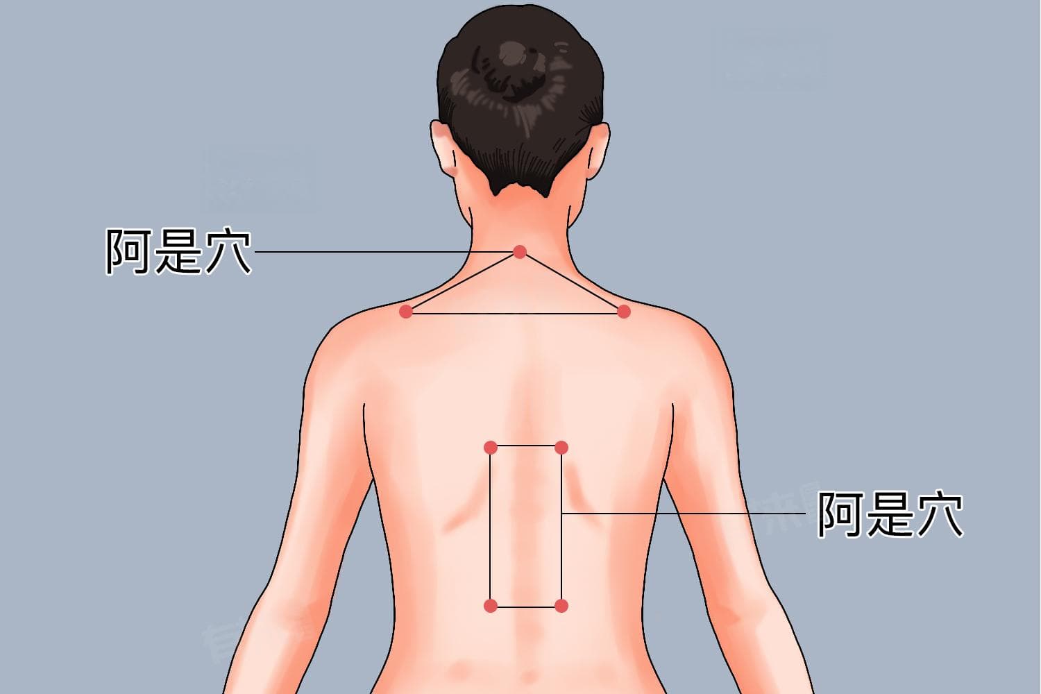 腰疼针灸哪个部位最快