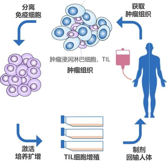 肿瘤浸润淋巴细胞(TIL)疗法全面解析