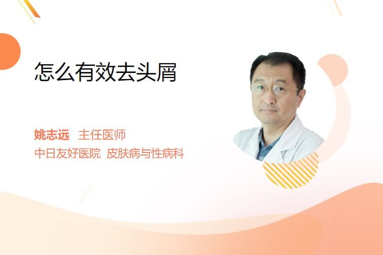 怎么有效去头屑