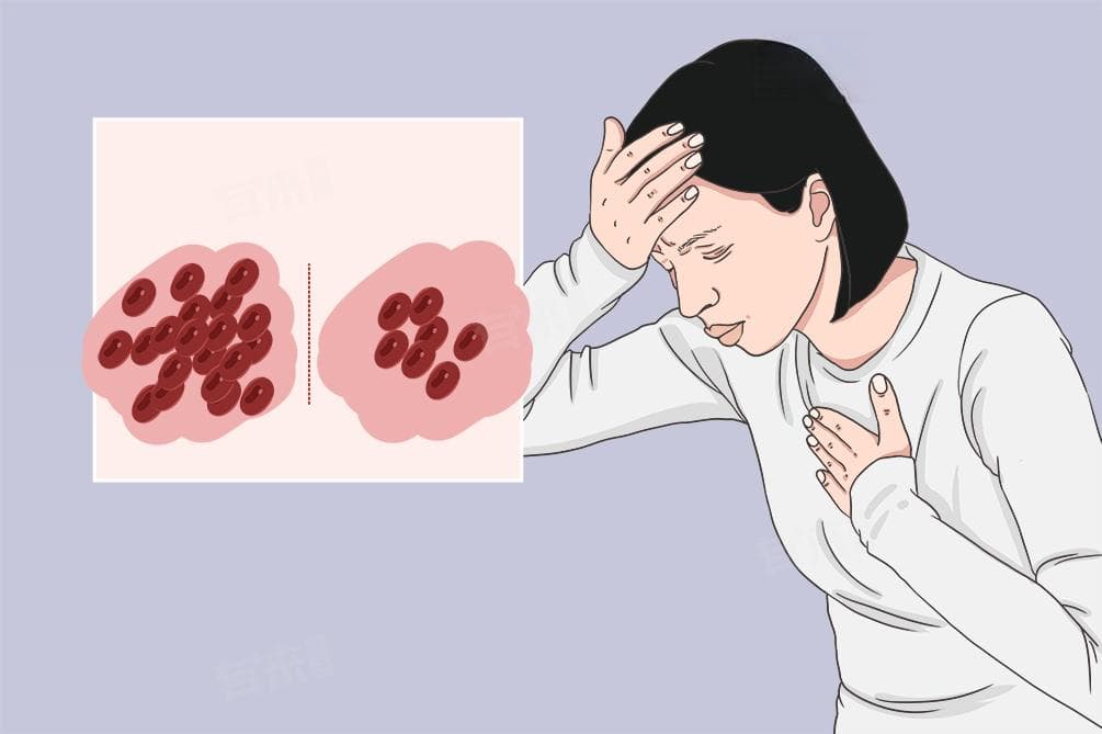 缺铁性贫血查什么项目能查出来