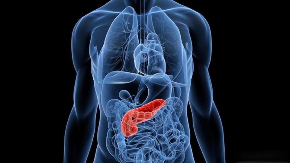 胰腺癌早期症状隐匿、诊断困难、治疗效果不佳！早期预防至关重要