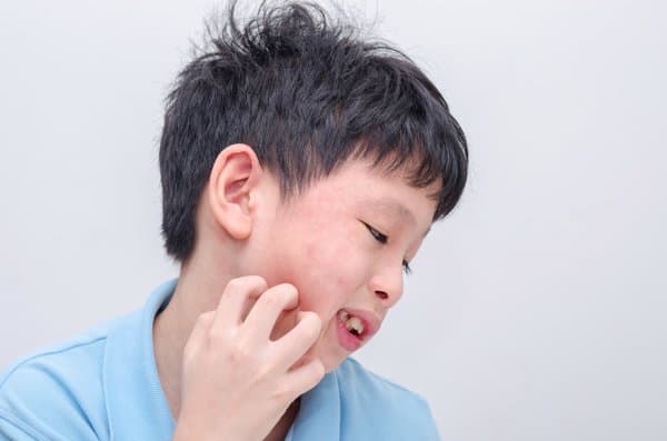 食用花生后过敏症状及应对方法