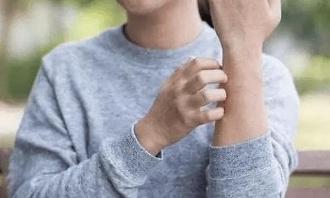 喝蜂蜜水过敏症状及应对方法