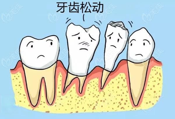 口腔疾病都有哪些症状表现，通过这些症状图片可见一二