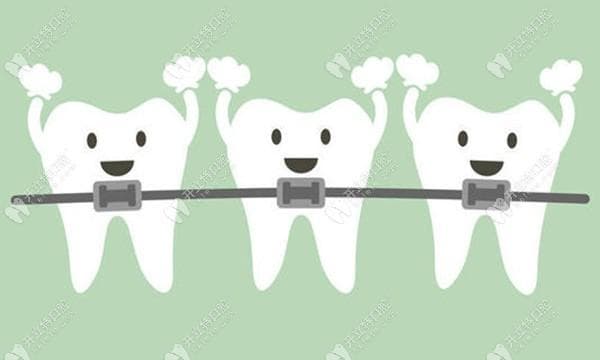成人下颌骨后缩有必要正畸吗?下颌后缩可通过正畸正颌改善