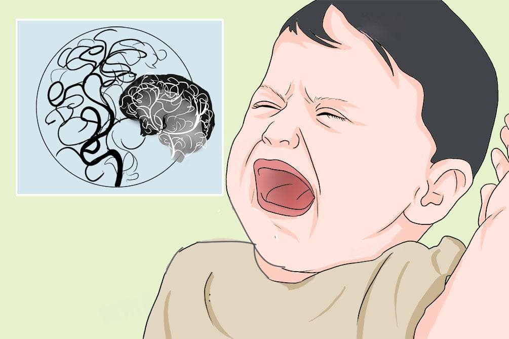 烟雾病的治疗方法有哪些？