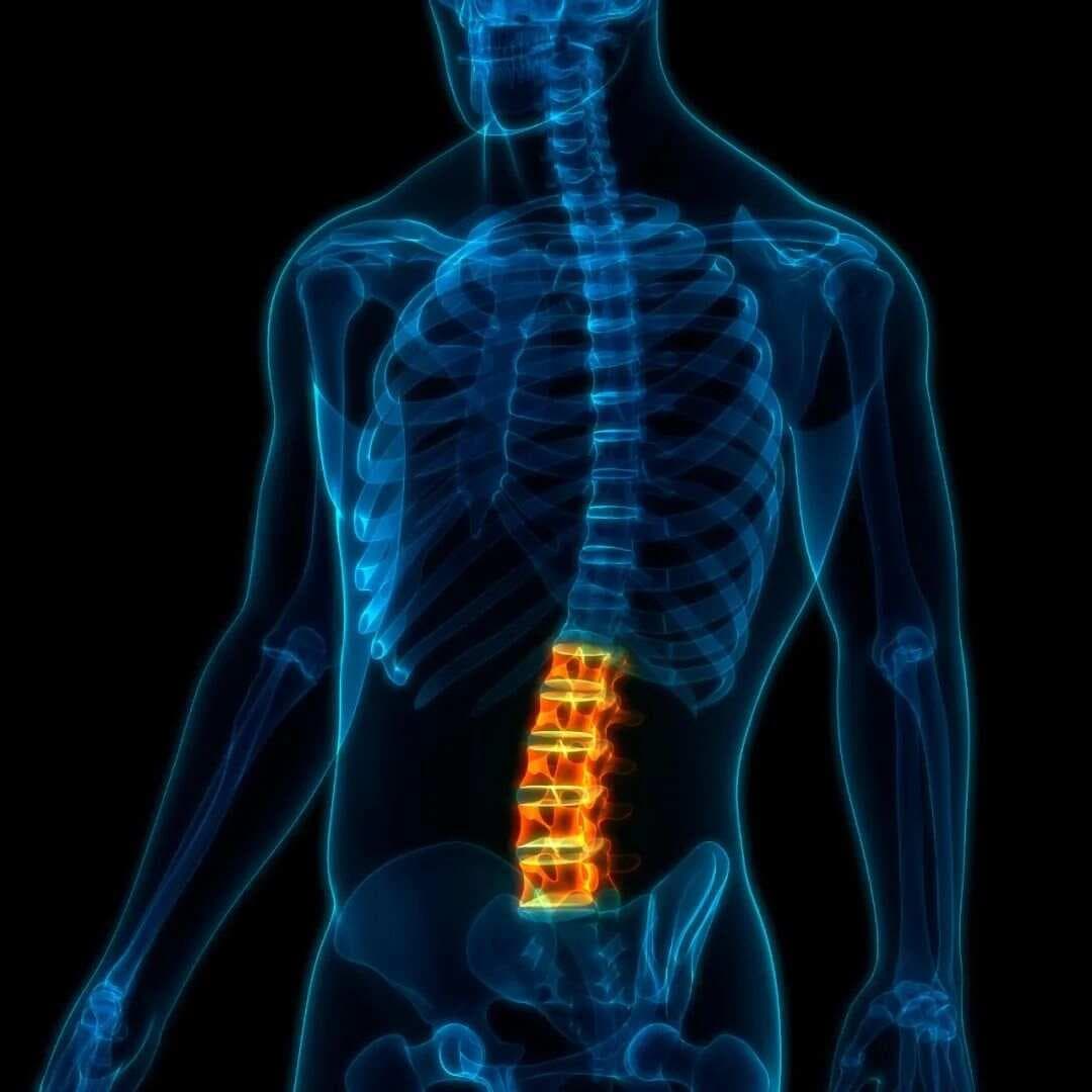 最新专家共识：腰椎间盘突出症中西医结合治疗方案详解