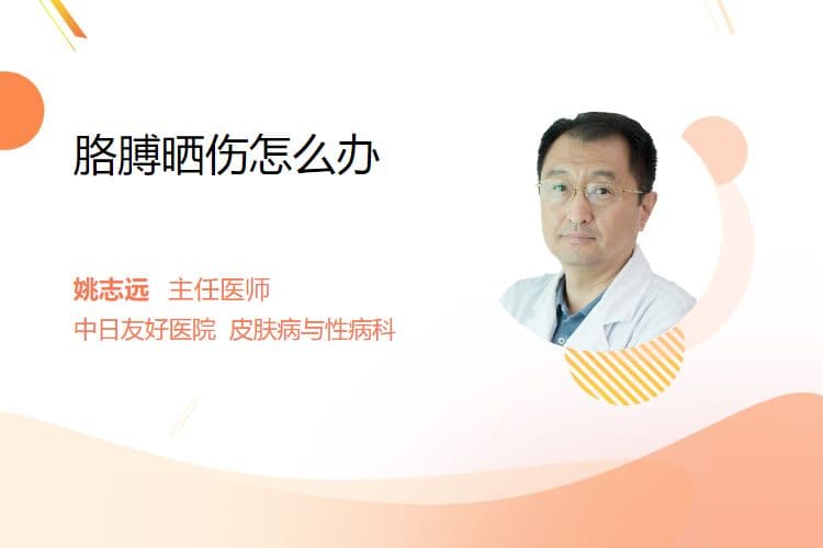 胳膊晒伤怎么办？4个关键步骤助你快速恢复