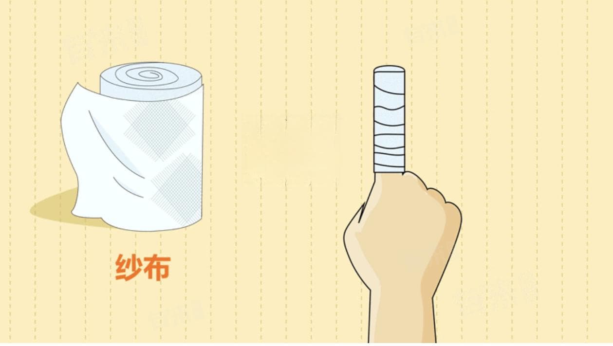 纱布多久换一次