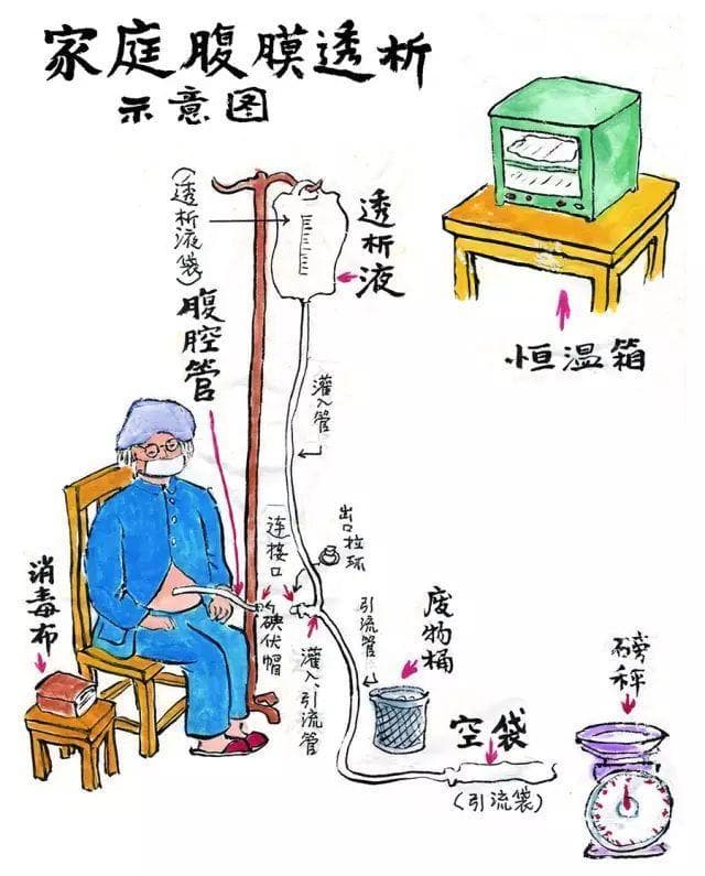 血液透析VS腹膜透析，谁更胜一筹？