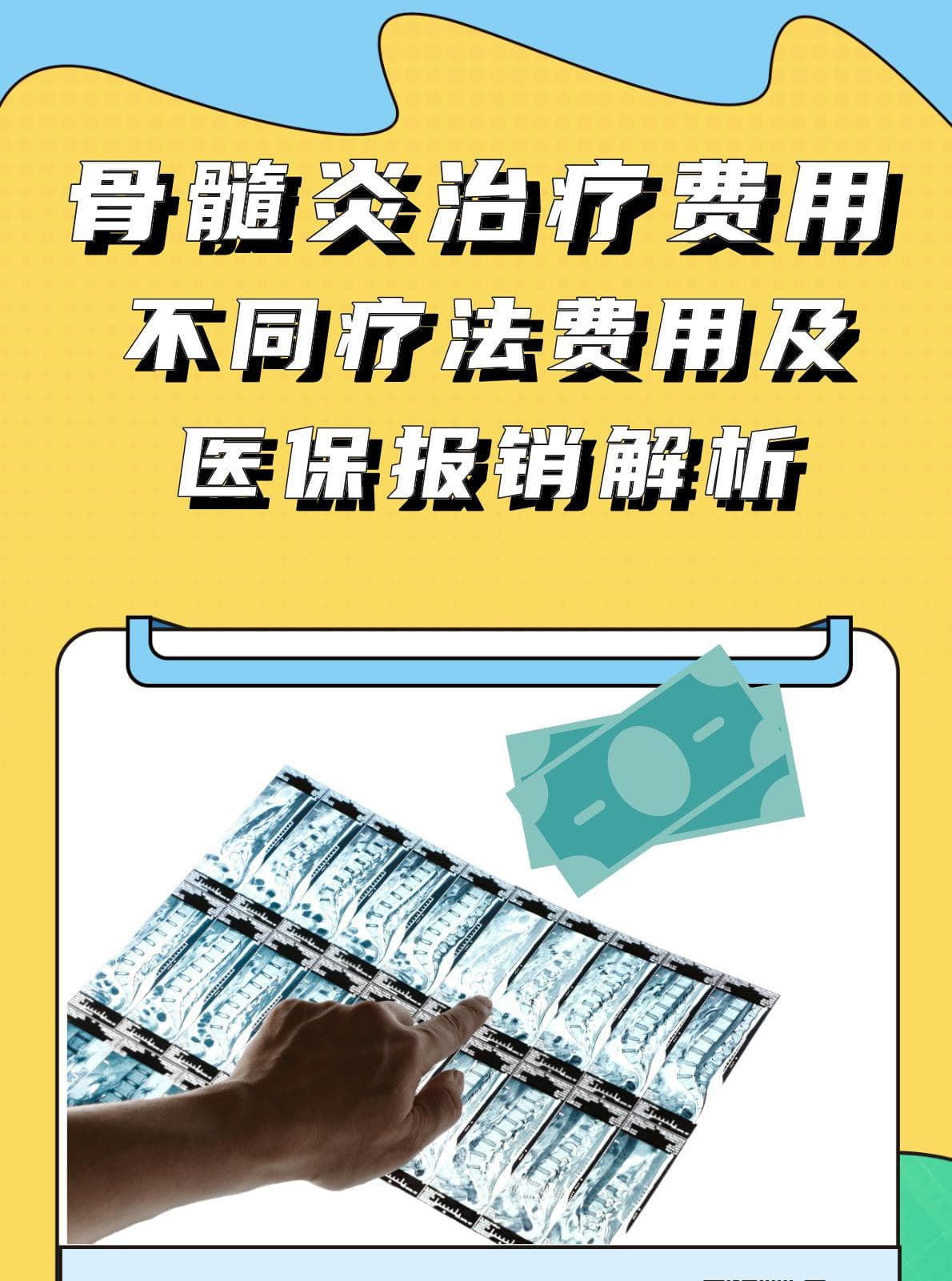 骨髓炎治疗费用：不同疗法费用及医保报销解析