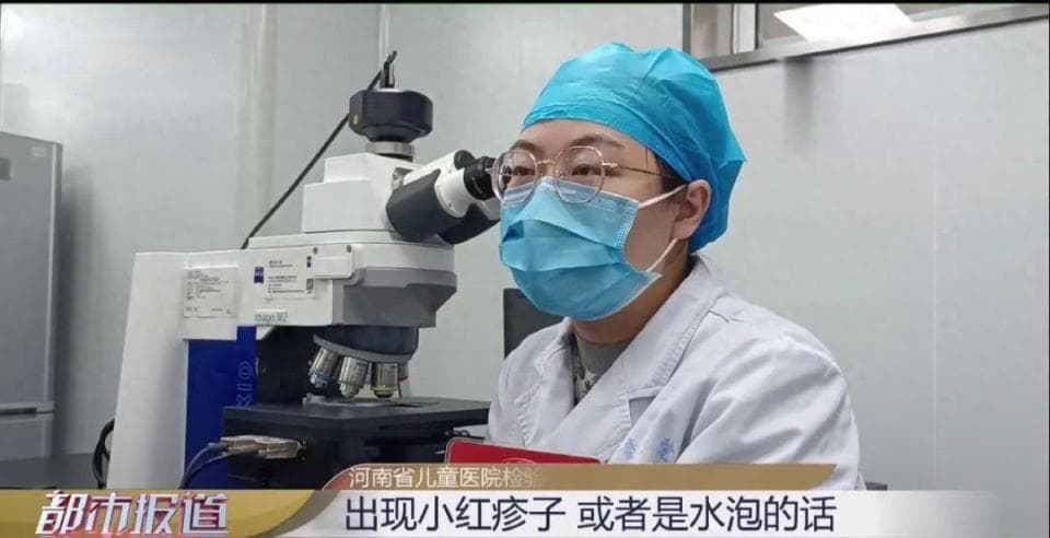 7岁女童脸上长水泡竟是脚气感染，这些传播途径和防治方法要当心