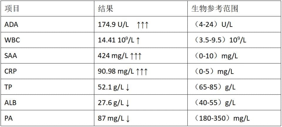 一例血清ADA异常增高辅助临床诊断肺结核病的应用价值