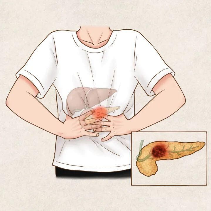 人体沉默的守护者——胰腺，日常应如何更好地呵护胰腺健康？