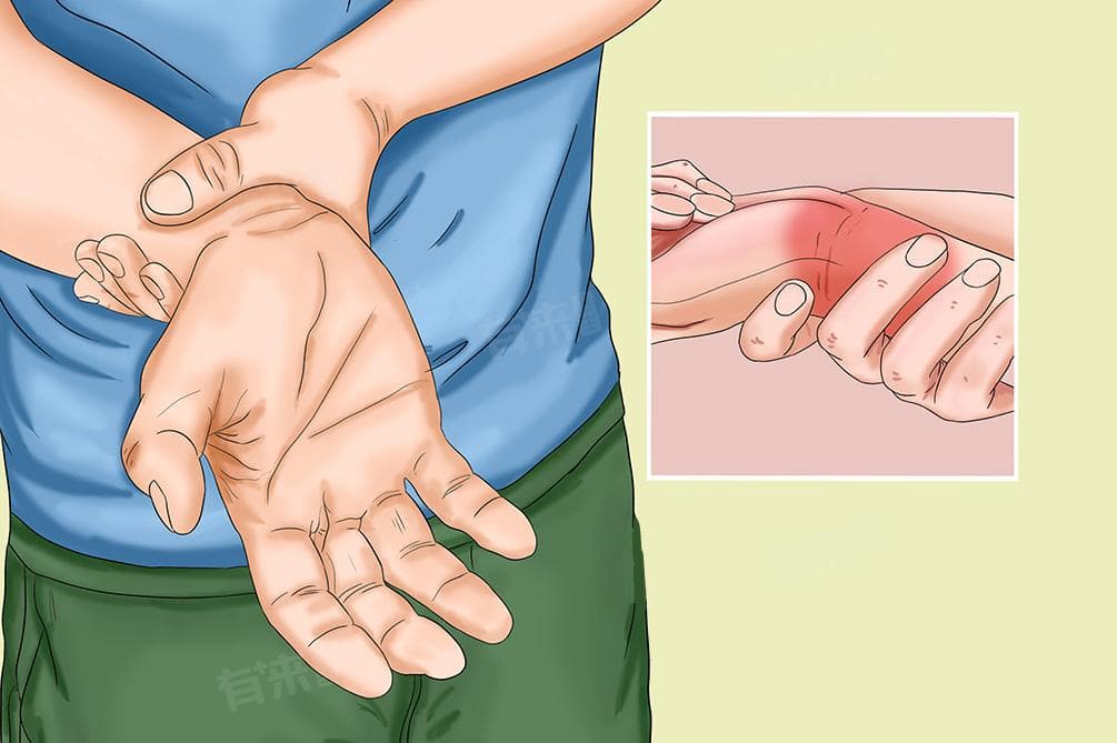 手腕肿胀要警惕这四种病