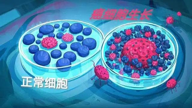防癌新纪元：如何让日常生活习惯成为抗癌前线