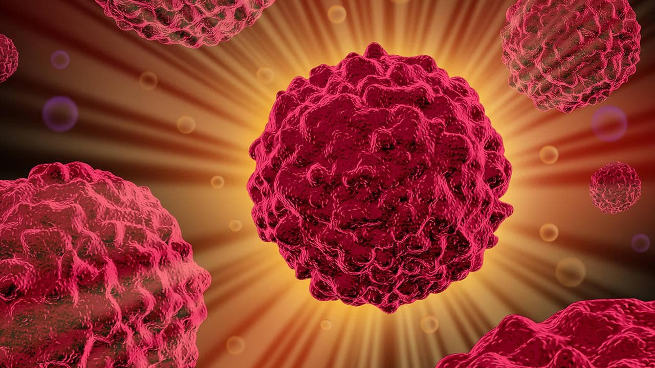 肺腺癌放疗后肺感染能活多久？生存率受哪些因素影响？