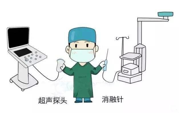 肝癌治疗新选择：微波消融术的优势与应用