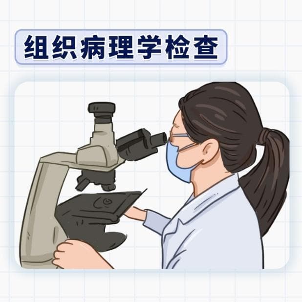 病理揭秘：儿童神经母细胞瘤的“诊断金钥匙”