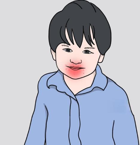 手足口病通过什么传播