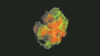 科学家在胰腺中找到控制血糖的“第一反应”细胞
