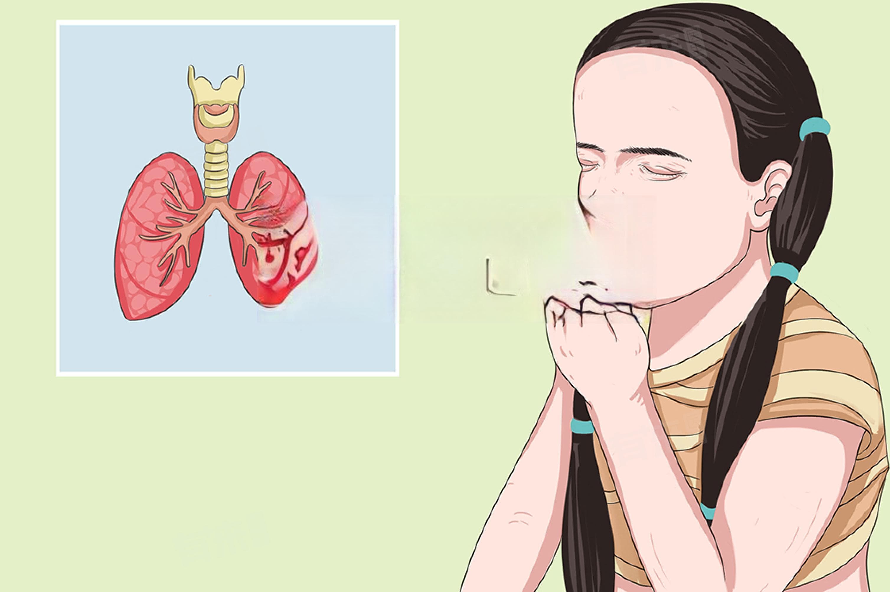 宝宝咳嗽喉咙有痰怎么办？5种安全有效的方法