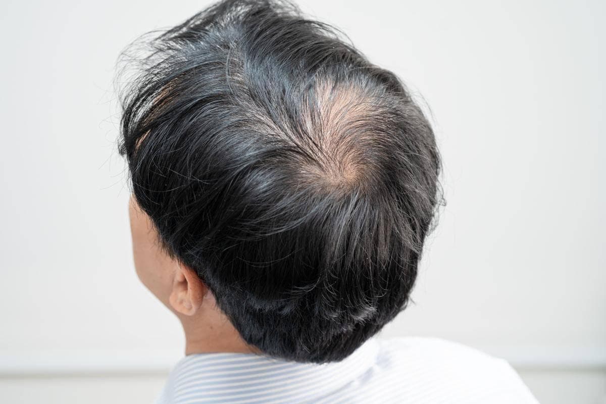 为什么掉的都是黑发，白发不掉呢？