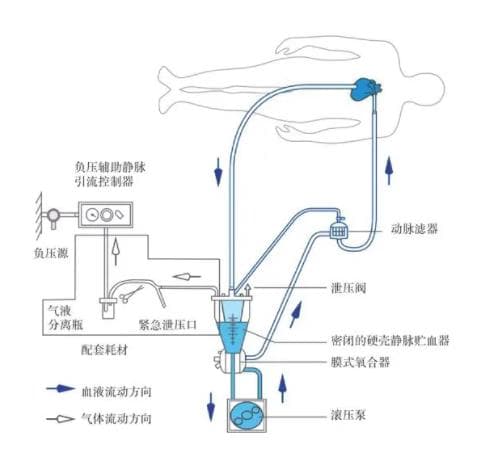 体外循环监视仪：原理、作用与使用方法详解