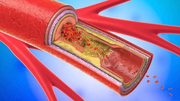 别把自己吓病了！体检报告出现这几种"病"，其实不宜过度治疗