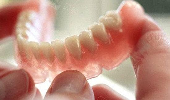 胶托和钢托假牙的区别：材料、强度、色泽度、使用感受和价格全方位解析