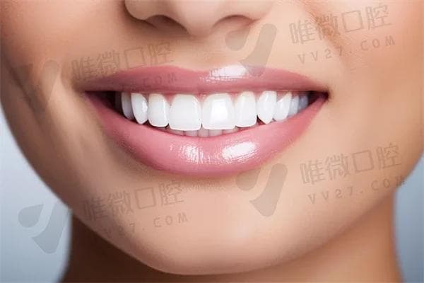 补充医疗保险能否报销牙齿矫正费用？一文读懂相关政策与规定