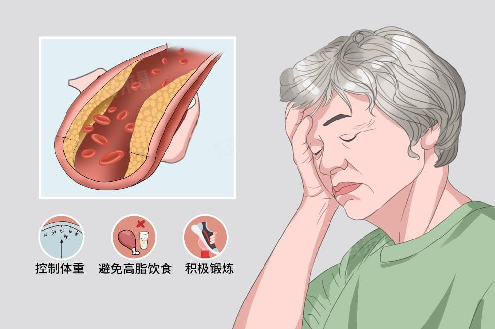 高血脂是指什么？一文读懂高血脂的定义与护理要点