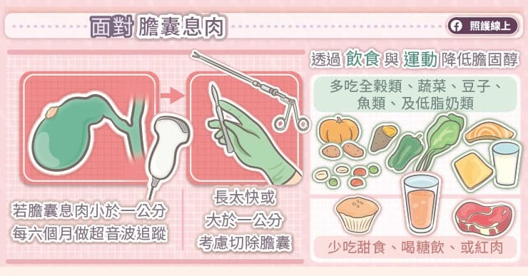 胆囊息肉的真相：从发现到处理的全面指南