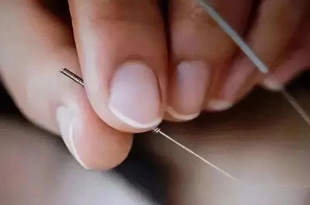 针灸时出现滞针、断针、晕针怎么办？