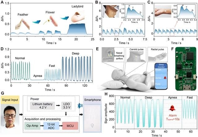 科学家实现睡眠呼吸暂停综合症（SAS）的精准监测