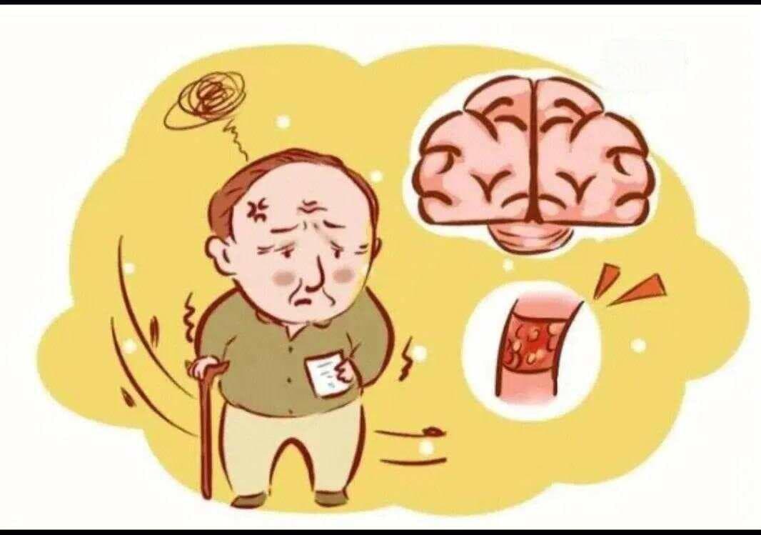 治疗脑梗死的5个中成药，一文总结