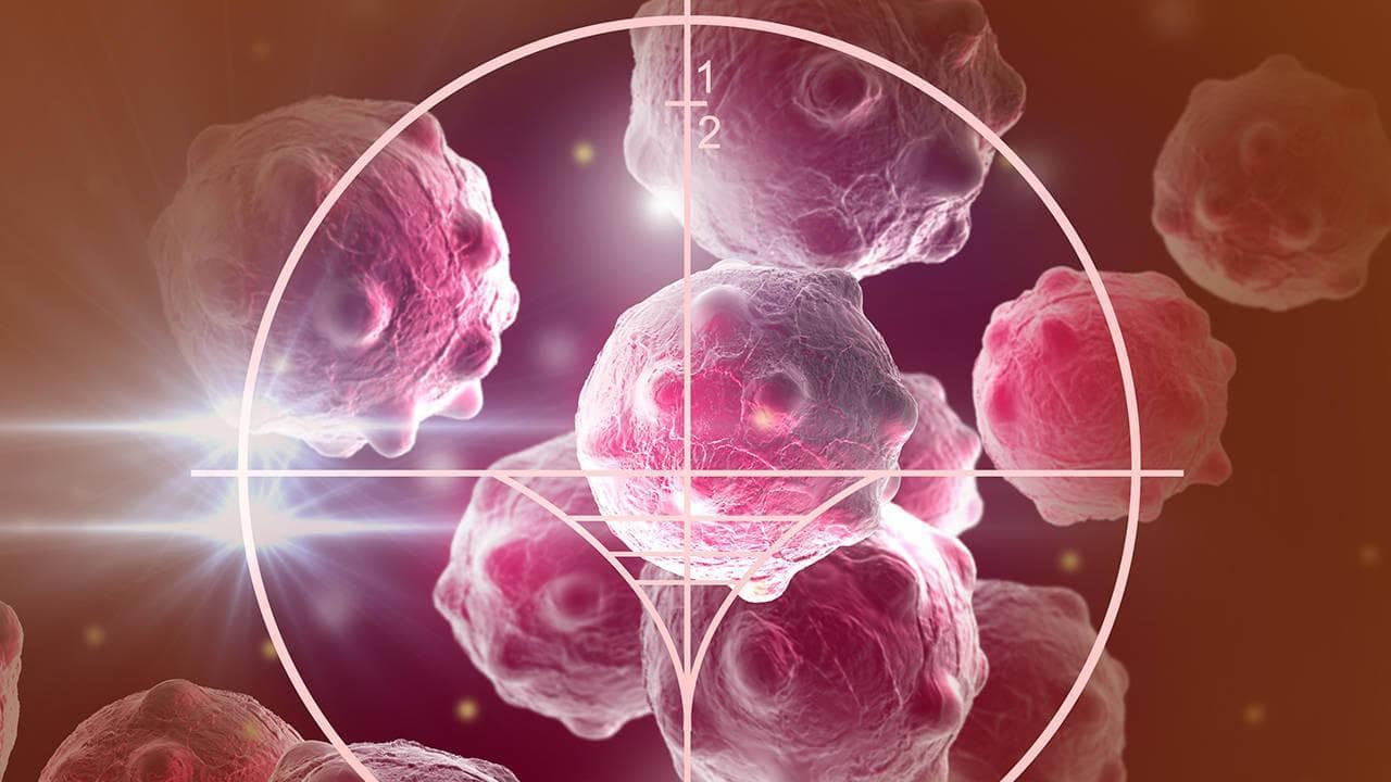 结肠癌晚期化疗后出虚汗怎么办？能解决吗