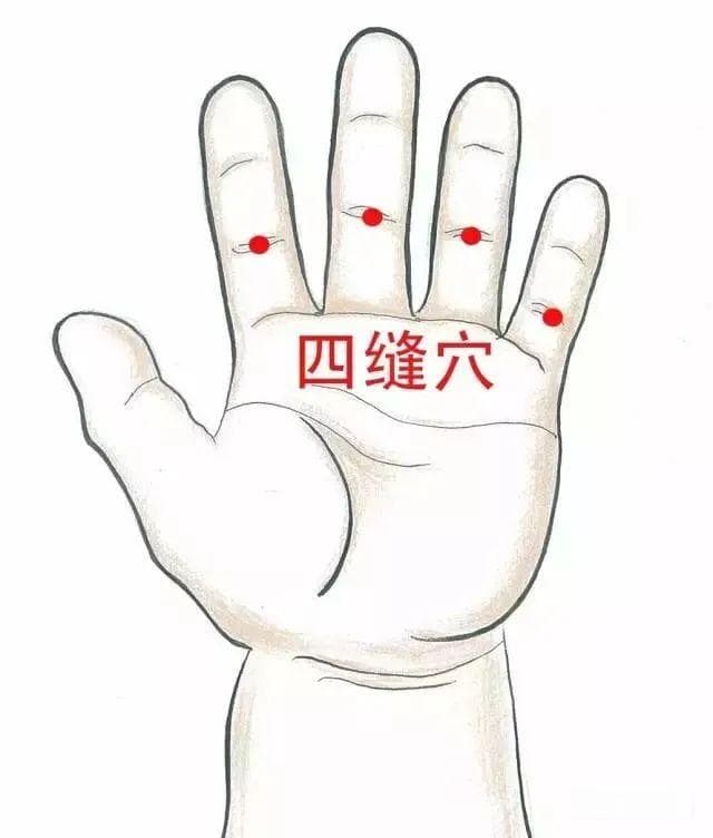 放血疗法：中医传统疗法的现代应用