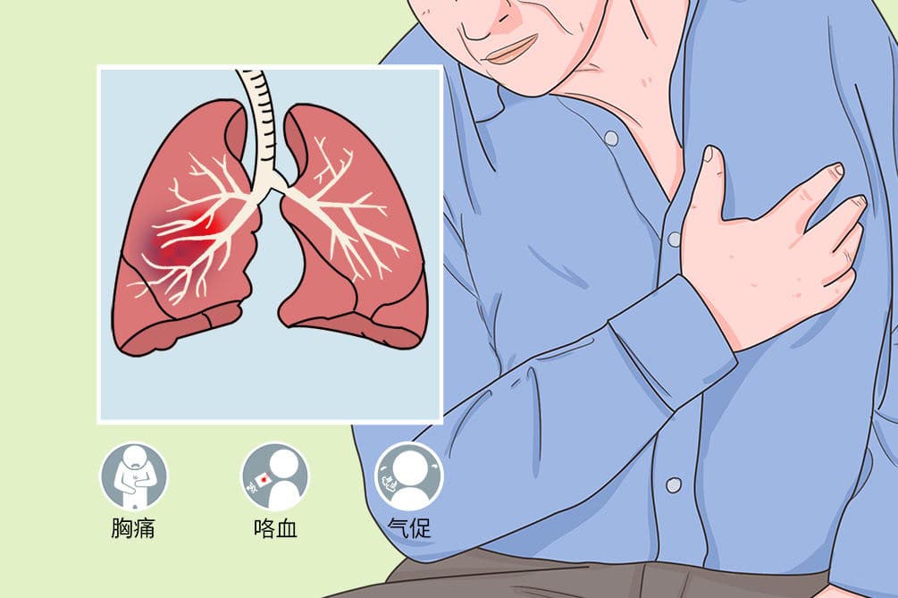 肺损伤：病因、症状、诊断与治疗全解析
