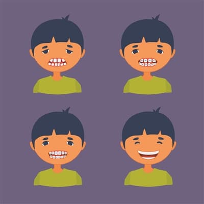 孩子换牙期 当心这些问题毁颜值