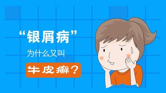我国超过六百万人患有银屑病，日常做好4点，70%患者可控制