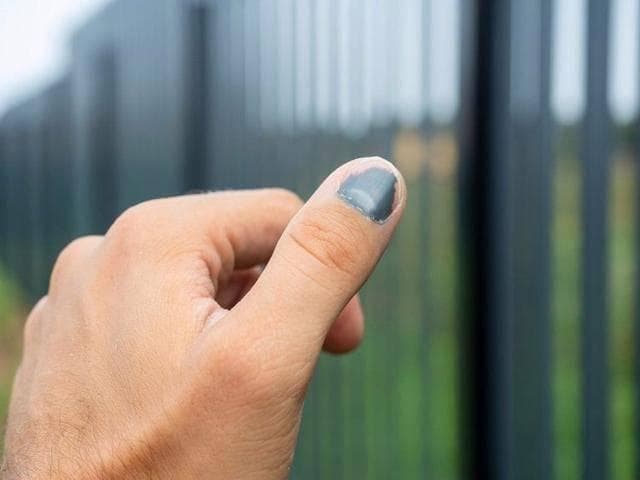 为什么指甲上有黑线？指甲若出现5种异常，可能是癌或疾病的信号