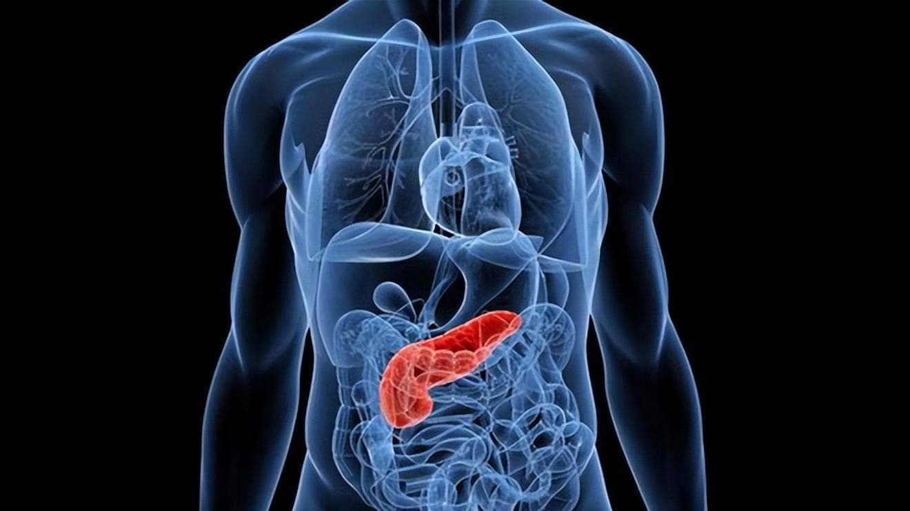 胰腺癌早期症状隐匿、诊断困难、治疗效果不佳！早期预防至关重要