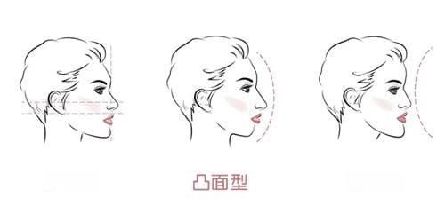 儿童唇肌训练器有用吗？唇肌训练缓解嘴唇外凸适合多大孩子？
