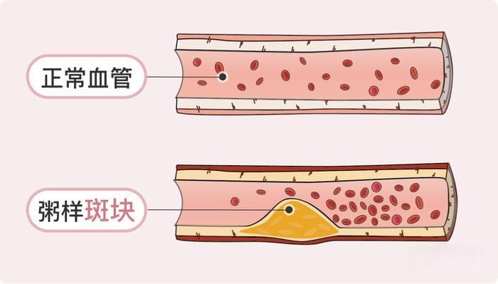 “最佳血压值”出炉？血压控制在这个数，心血管病、死亡风险大大降低！