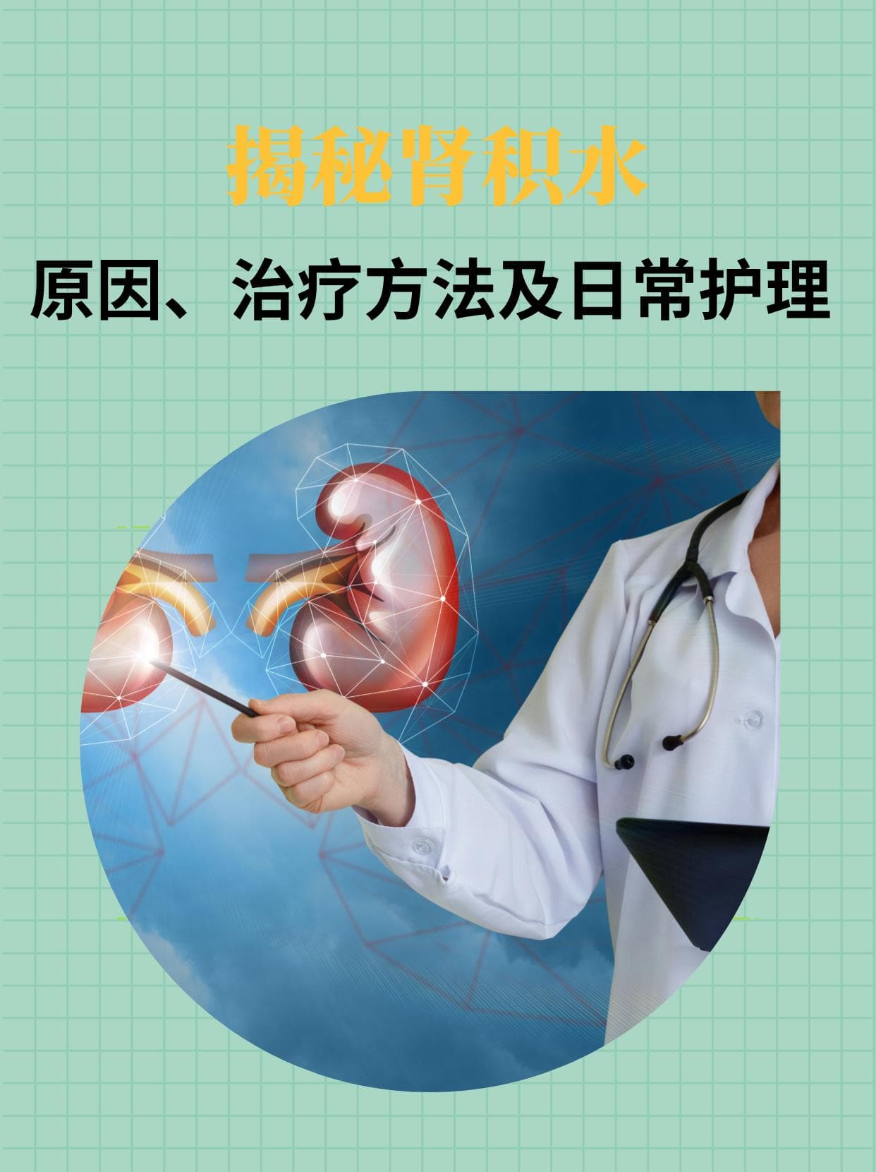 揭秘肾积水：原因、治疗方法及日常护理