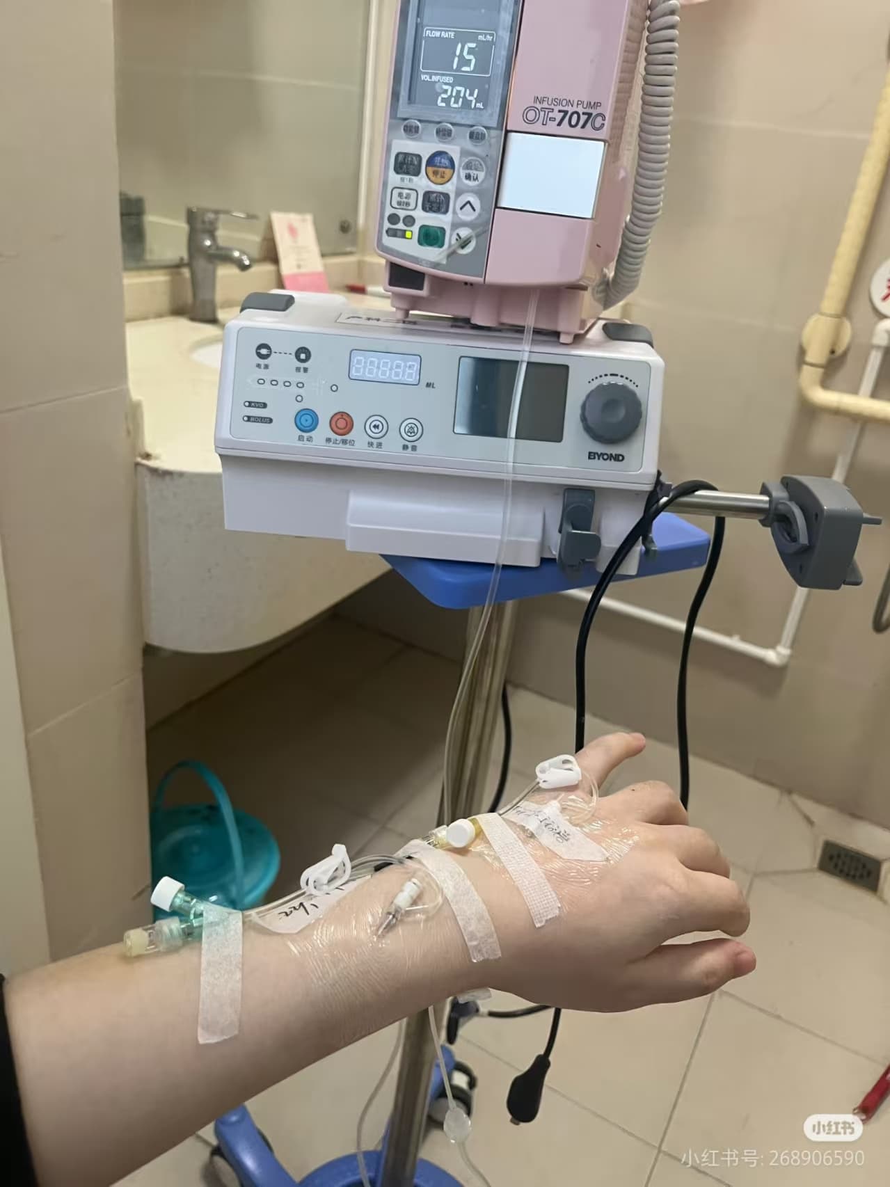 孕妇被行李砸中致胎儿早产离世，如何划定责任？
