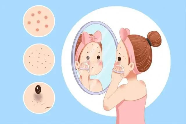 氨甲环酸：黄褐斑的“克星”？